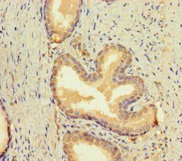 Bone morphogenetic protein 4 antibody