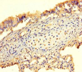 Bone morphogenetic protein 4 antibody