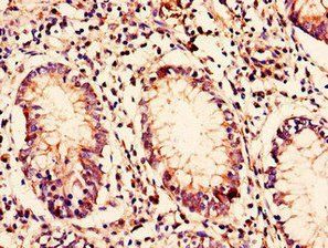 BORCS7 Antibody