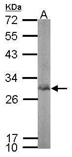 BPGM antibody [N1C3]