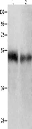 BPIFB1 antibody