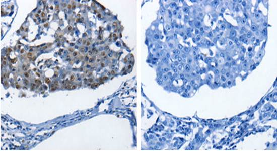 BPIFB1 Rabbit Polyclonal Antibody
