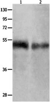 BPIFB1 Rabbit Polyclonal Antibody