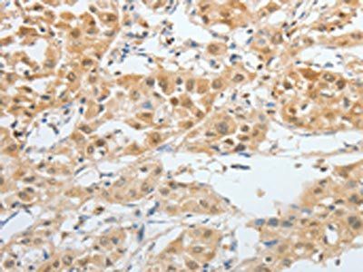 BPIFB2 Antibody