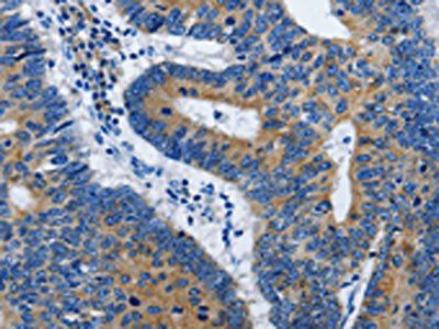 BPIFB3 Antibody