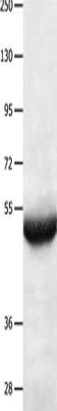 BPIFB3 Antibody