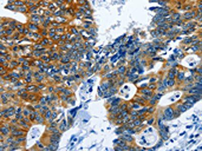 BPIFB3 Antibody