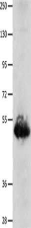 BPIFB3 antibody