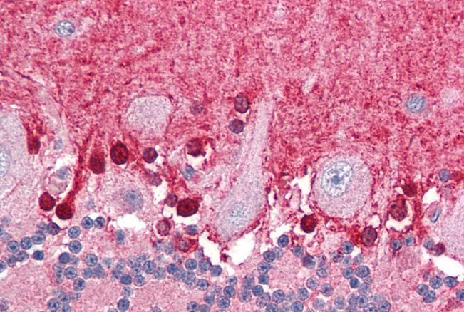 Goat anti-BPOZ / ABTB1 Antibody