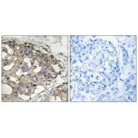 BRAF Antibody