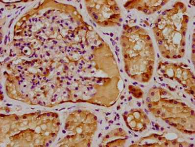 BRAT1 Antibody