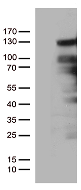 BRCA1 Antibody