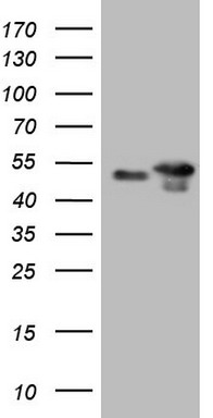 BRCA1 Antibody