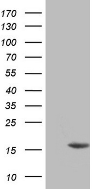BRCA1 Antibody