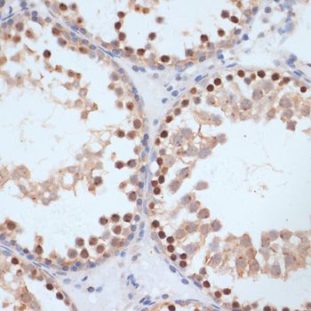 BRCA1 (Phospho-S1423) antibody