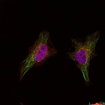 BRCA1 (Ab524) Antibody