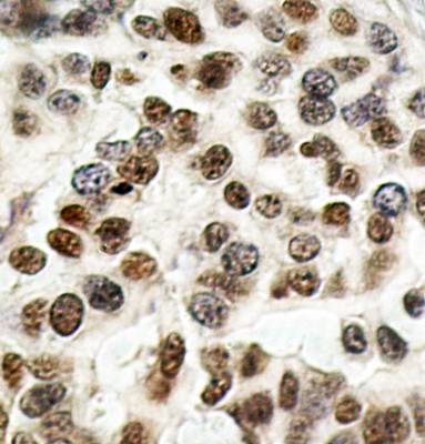 BRCA1 (Ab423) Antibody