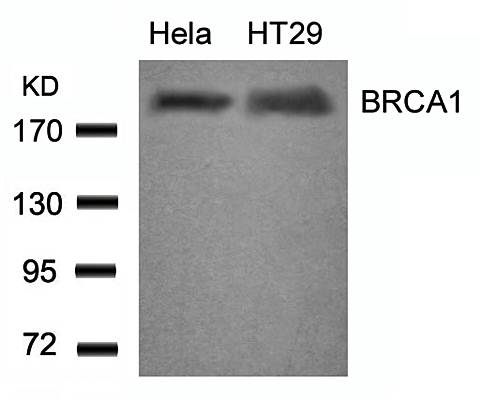 BRCA1 (Ab423) Antibody