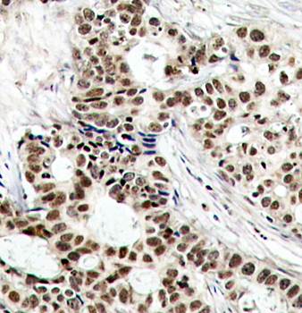 BRCA1 (Phospho-Ser1423) Antibody