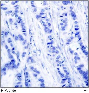 BRCA1 (Phospho-Ser1524) Antibody