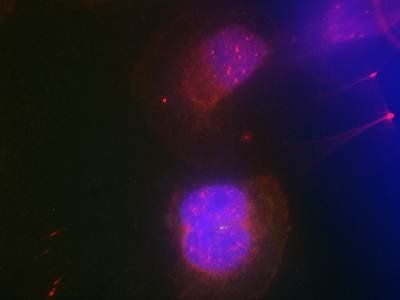 BRCA1 (Phospho-Ser988) Antibody