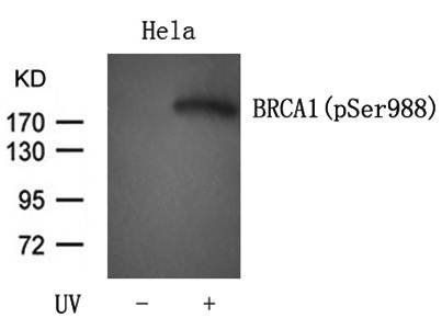 BRCA1 (Phospho-Ser988) Antibody