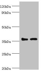 BRCC3 antibody