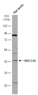 BRISC and BRCA1 A complex member 2 Antibody