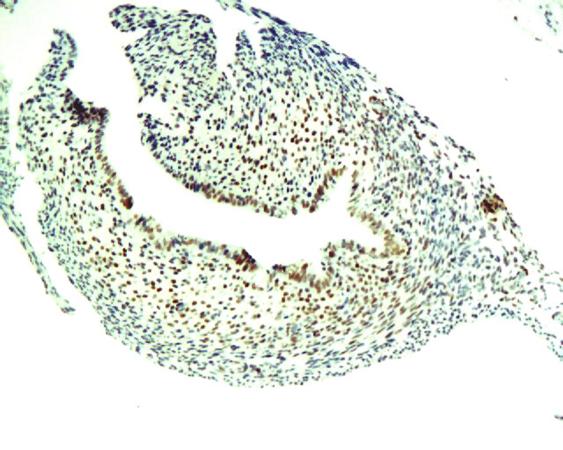 BrdU (Proliferation Marker) Rabbit Polyclonal Antibody