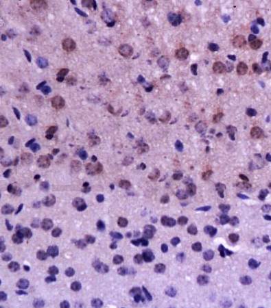 BrdU (Proliferation Marker) Rabbit Polyclonal Antibody