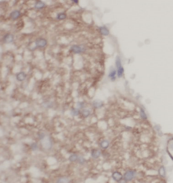 Brevican antibody