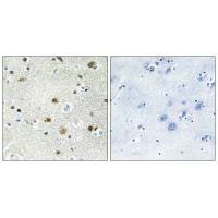 BRF1 Antibody