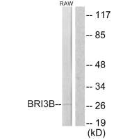 BRI3BP antibody