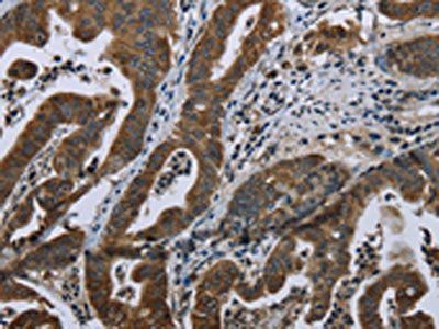 BRINP1 Antibody