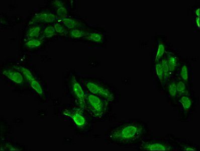 BRIP1 Antibody