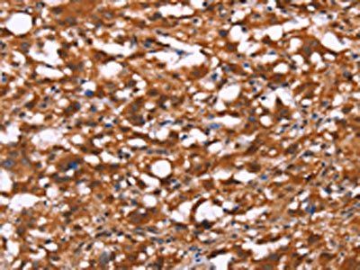 BRK1 Antibody