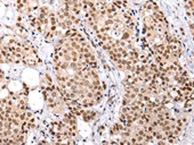 BRMS1 Antibody