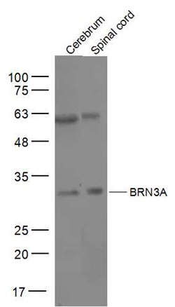 BRN3A antibody