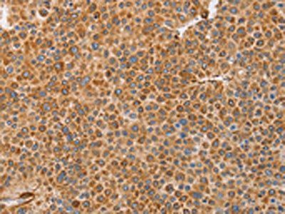 BRS3 Antibody