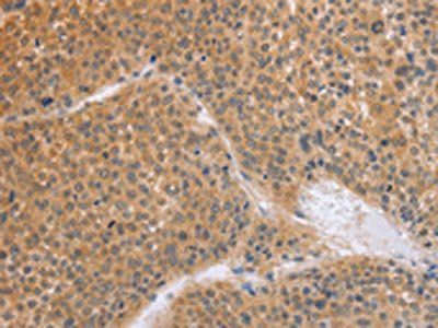 BRS3 Antibody