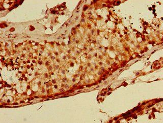 BRSK1 antibody