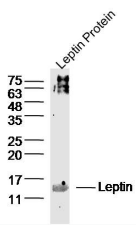 Leptin antibody
