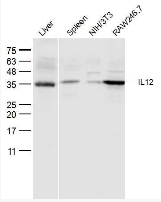 IL12 antibody