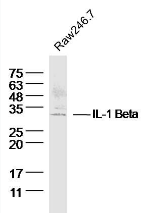 IL1 beta antibody