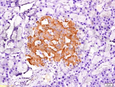 PDX1 Rabbit Polyclonal Antibody