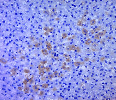 p70 S6 Kinase beta antibody