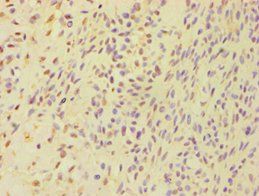 BSND antibody