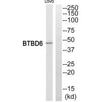 BTBD6 antibody