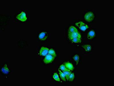 BTBD2 Antibody