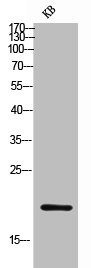 BTC antibody